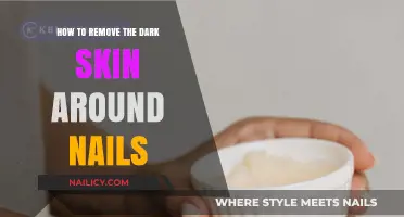 Get Rid of Dark Skin Around Nails