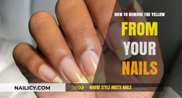 Get Rid of Yellow Nails: Effective Home Remedies