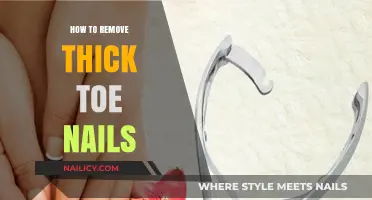 Thick Toenails: Effective Home Removal Techniques
