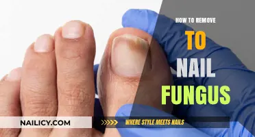 Eradicating Nail Fungus: Effective Home Remedies