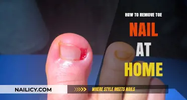 Effective Home Remedies for Removing Toenails