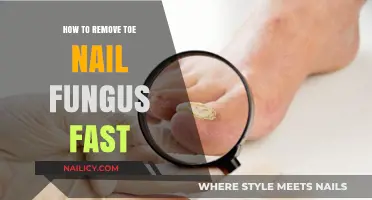 Fast-Acting Treatments for Toenail Fungus