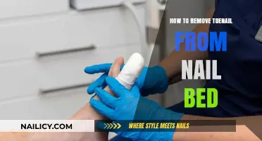 Removing Toenails: A Safe DIY Guide