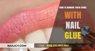 Tooth Gem Removal: Nail Glue Solution