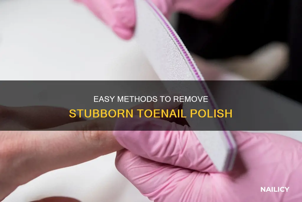 how to remove tp nail
