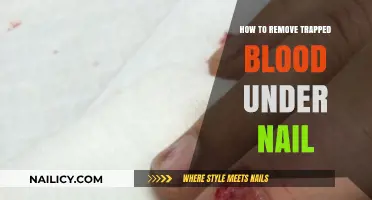 Relieving Trapped Blood Under Nails: Quick Home Remedies