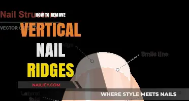 Get Rid of Vertical Nail Ridges: Simple Solutions