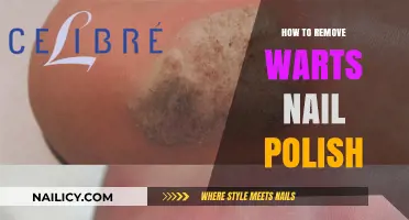 Effective Wart Removal: Nail Polish Method