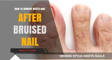 Healing a Bruised Nail: Removing the Waste
