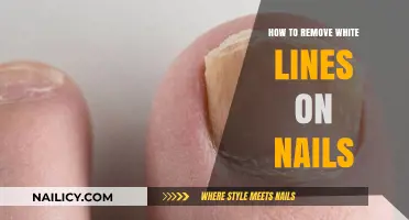 Erase Nail White Lines: Simple Home Remedies