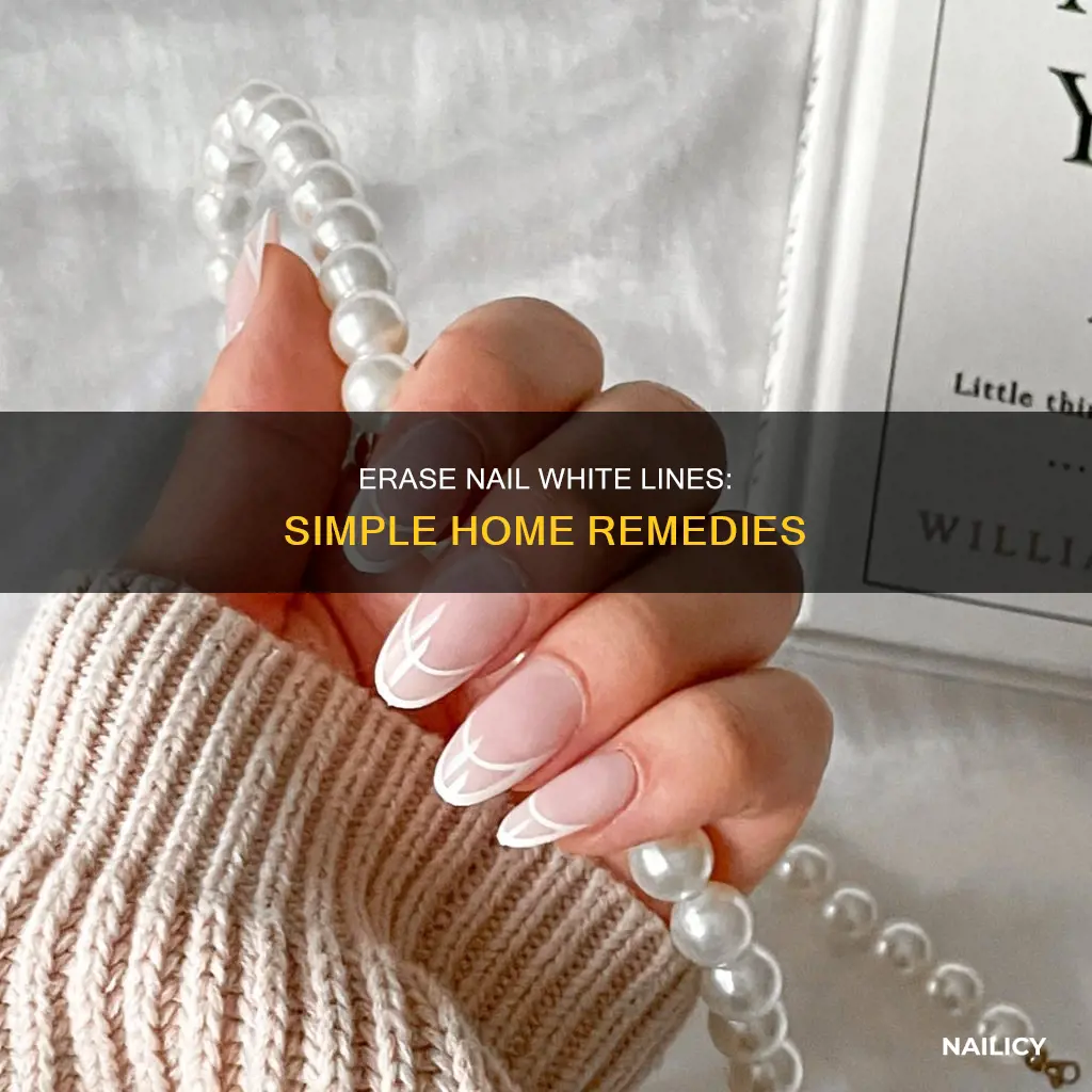 how to remove white lines on nails