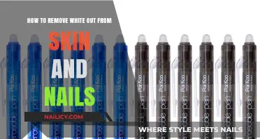 Erase White-Out Stains From Skin and Nails: Quick Solutions