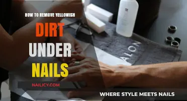 Get Rid of Yellowish Dirt Under Nails Easily
