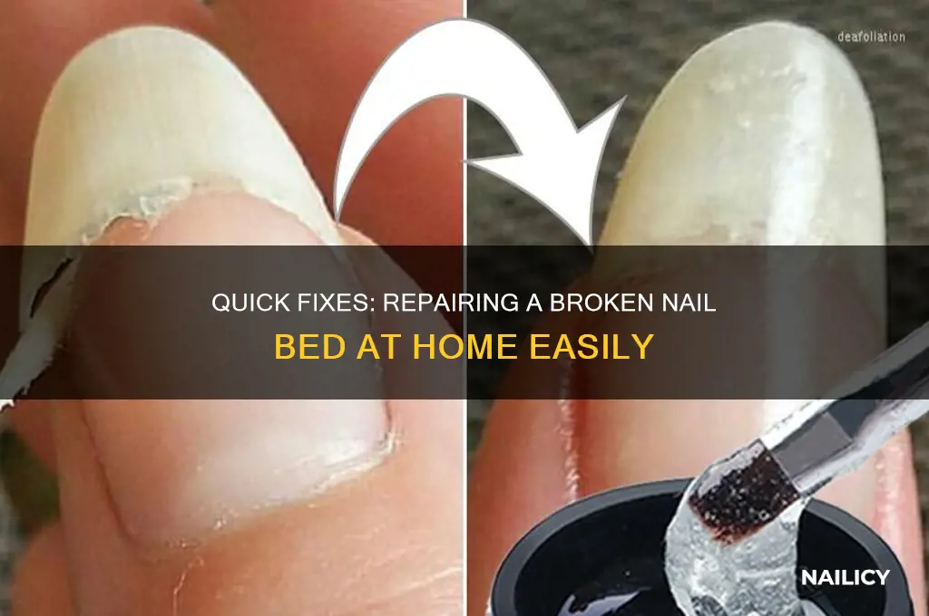 how to repair a broken nail bed