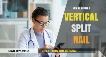 Fixing Vertical Split Nails: Quick Repair Tips for Healthy Nails
