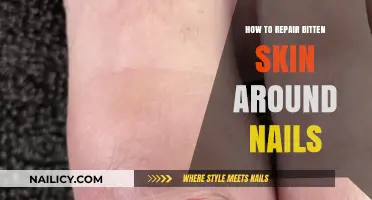 Heal and Restore: Repairing Bitten Skin Around Nails Effectively