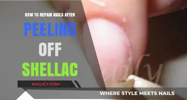 Revive Your Nails: Post-Shellac Peeling Repair Guide for Healthy Hands