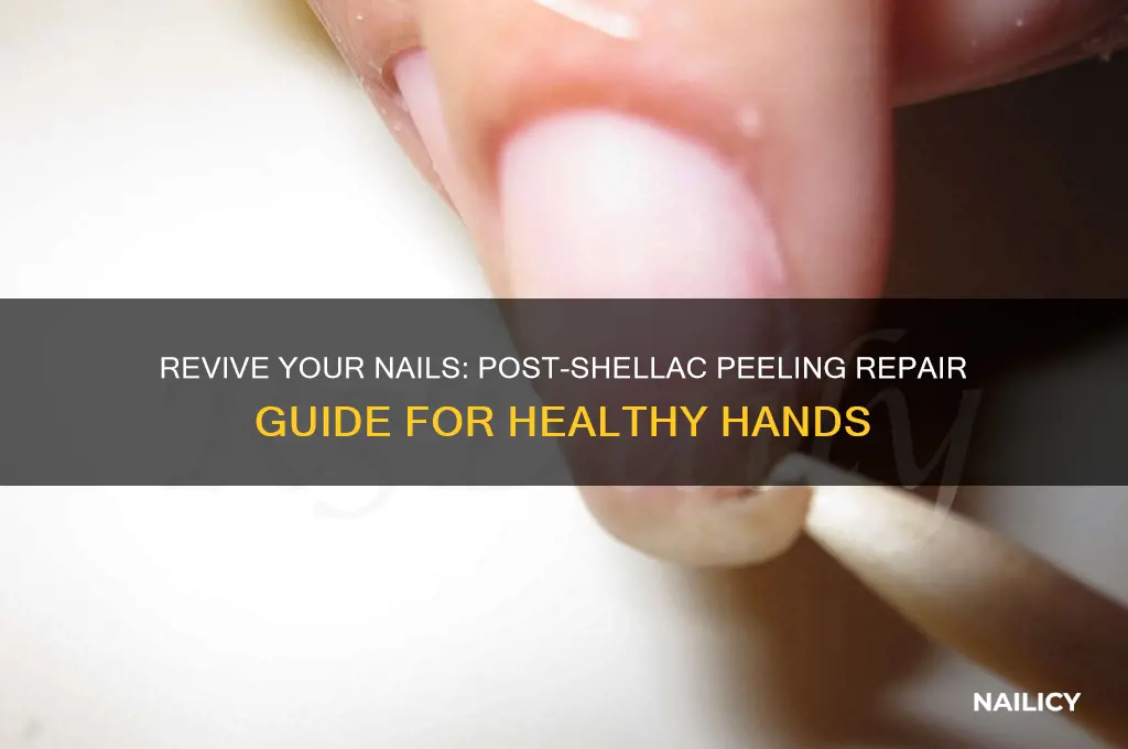 how to repair nails after peeling off shellac