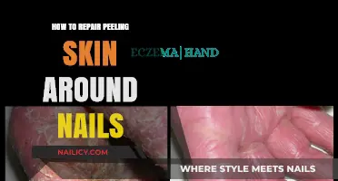 Fix Peeling Skin Around Nails: Simple, Effective Repair Tips