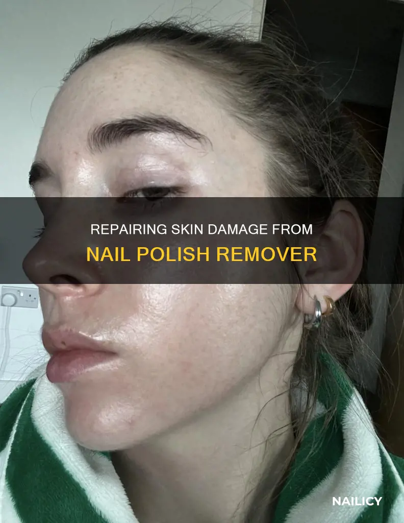how to repair skin damage from nail polish remover