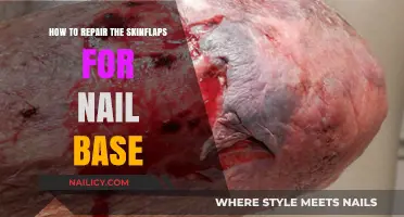 Effective Techniques to Repair Skin Flaps at the Nail Base