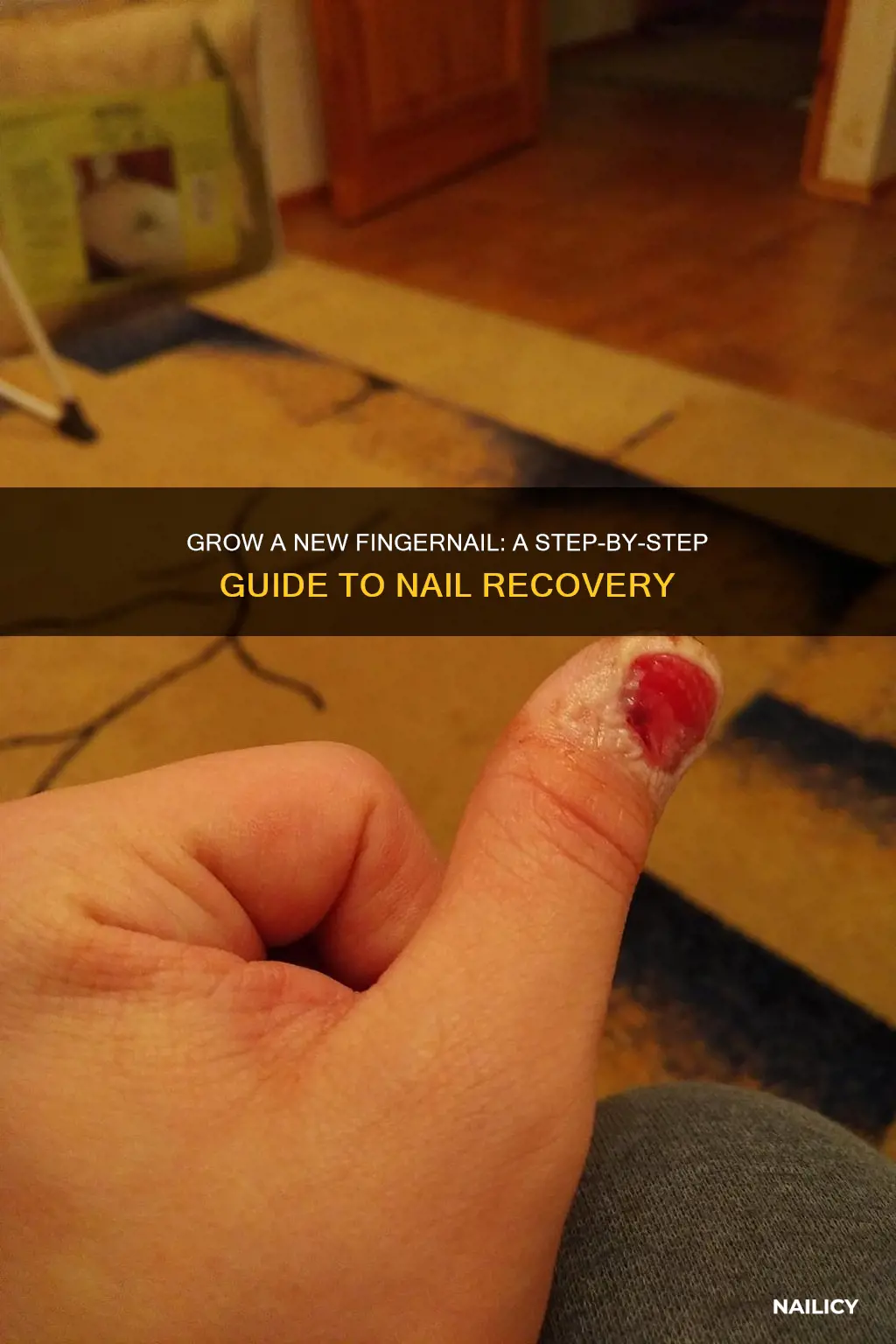 how to replace a finger without nail