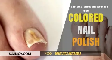 Restore Toenail Health: Reversing Discoloration from Colored Nail Polish