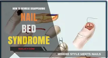 Reviving Nail Health: Effective Strategies to Reverse Disappearing Nail Bed Syndrome