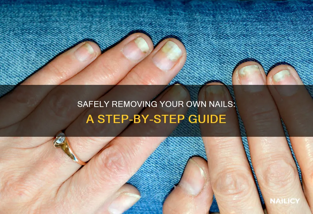 how to safely remove your own nail
