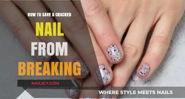 Quick Fixes: Rescue Your Cracked Nail and Prevent Further Breakage