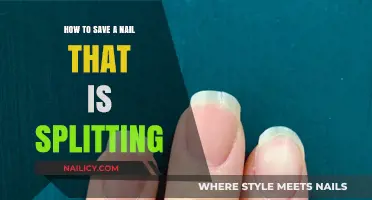 Quick Fixes: How to Save a Splitting Nail Easily
