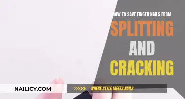 Protect Your Nails: Prevent Splitting and Cracking