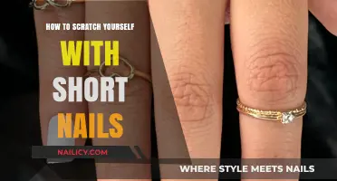 Short Nails, Big Relief: Effective Scratching Techniques for Itchy Skin