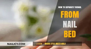 Safe Toenail Separation: A Guide to Detaching Toenails from Nail Beds