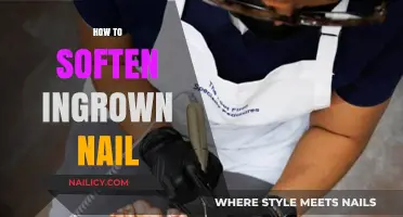 Effective Home Remedies to Soften and Treat Ingrown Toenails Fast