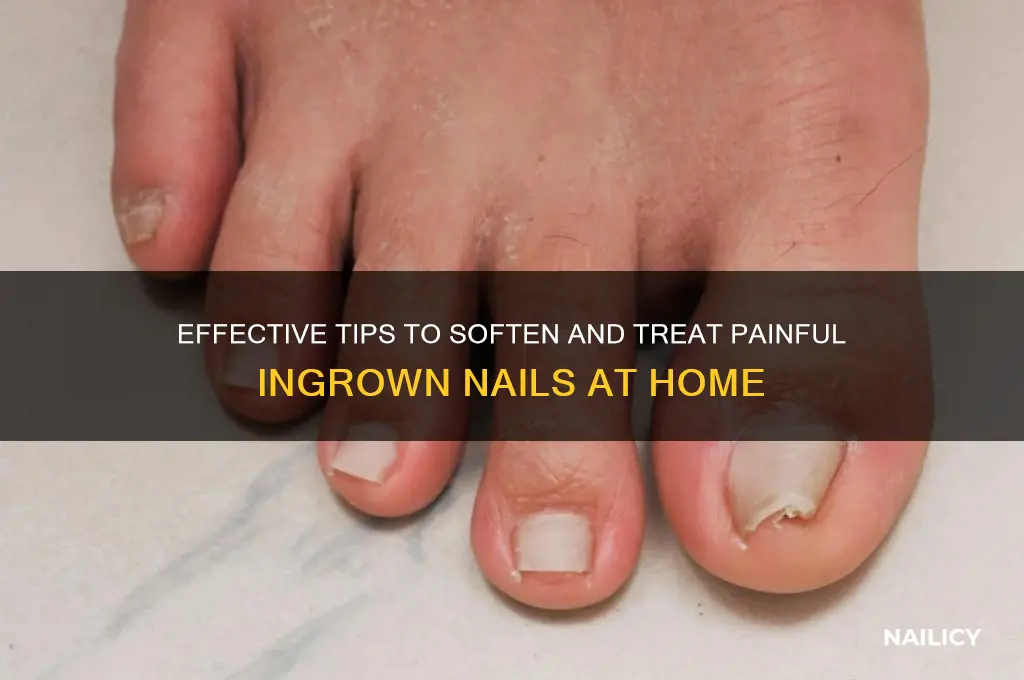 how to soften nails ingrown