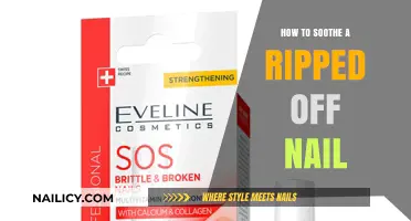 Quick Relief: Soothing a Ripped-Off Nail and Promoting Healing