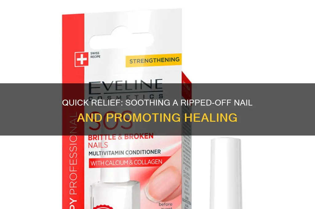 how to soothe a ripped off nail