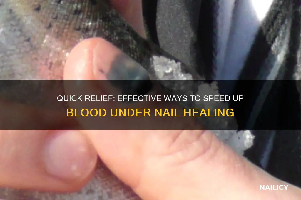 how to speed up blood under nail