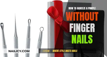 Squeezing Pimples: A Safe, Nail-Free Technique