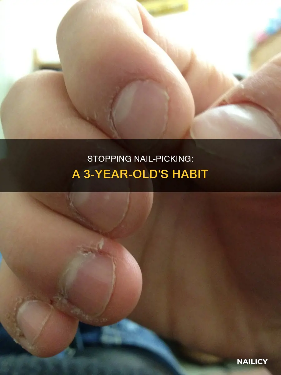 how to stop 3 year old from picking finger nails