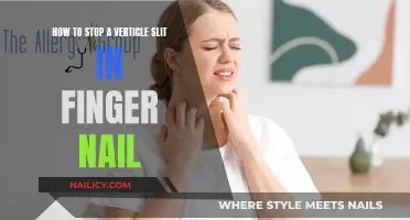 Repairing Vertical Slits in Fingernails: A Quick Guide