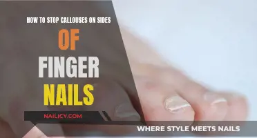 Preventing Callouses: Tips for Healthy Nails and Skin
