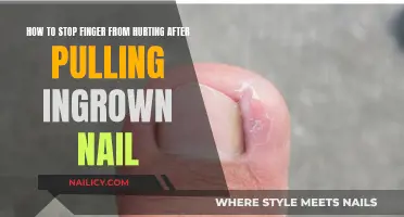 Relieve Pain from Ingrown Nail Removal: Tips and Tricks