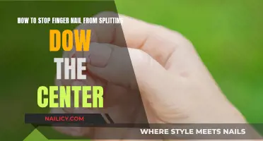 Preventing Fingernail Splitting: Tips and Tricks