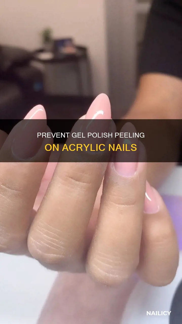 how to stop gel polish from peeling on acrylic nails