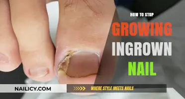 Eradicate Ingrown Nails: Tips for Healthy Toenails