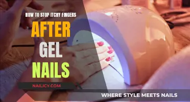 Gel Nails Itch: Stop Scratching and Start Soothing