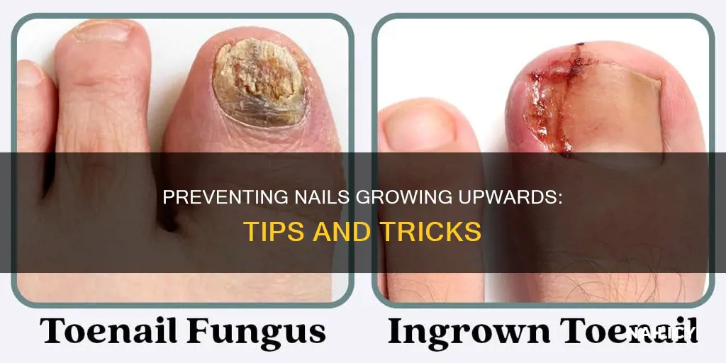 how to stop my nails from growing upwards