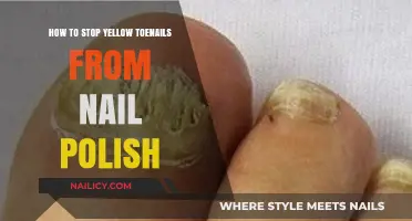 Prevent Yellow Toenails: Tips to Protect Nails from Nail Polish Stains